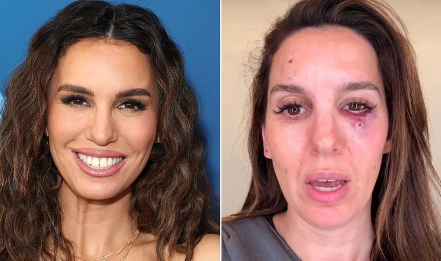 Eski Disney yıldızı Romano, ava giderken av oldu