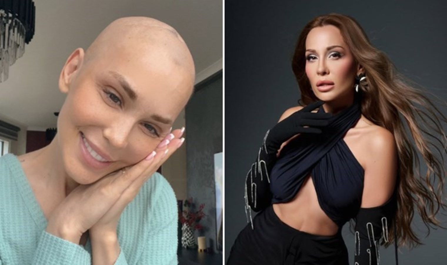 Kanseri 2 kez yenen Şimal 45 kiloya düştü