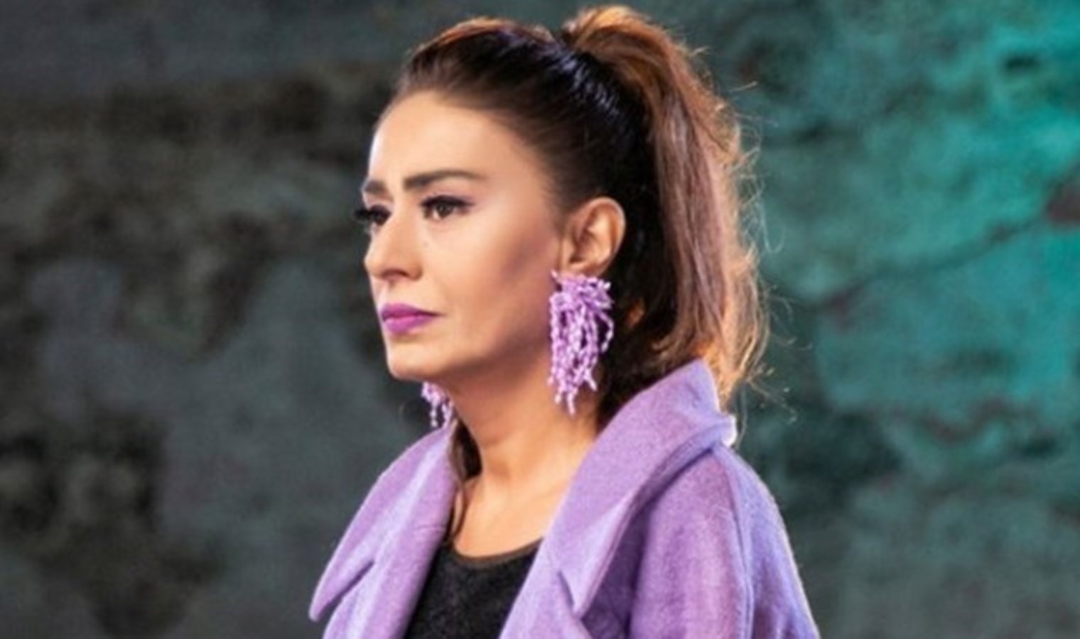 Son hali korkuttu: Yıldız Tilbe’nin yüzü yandı!