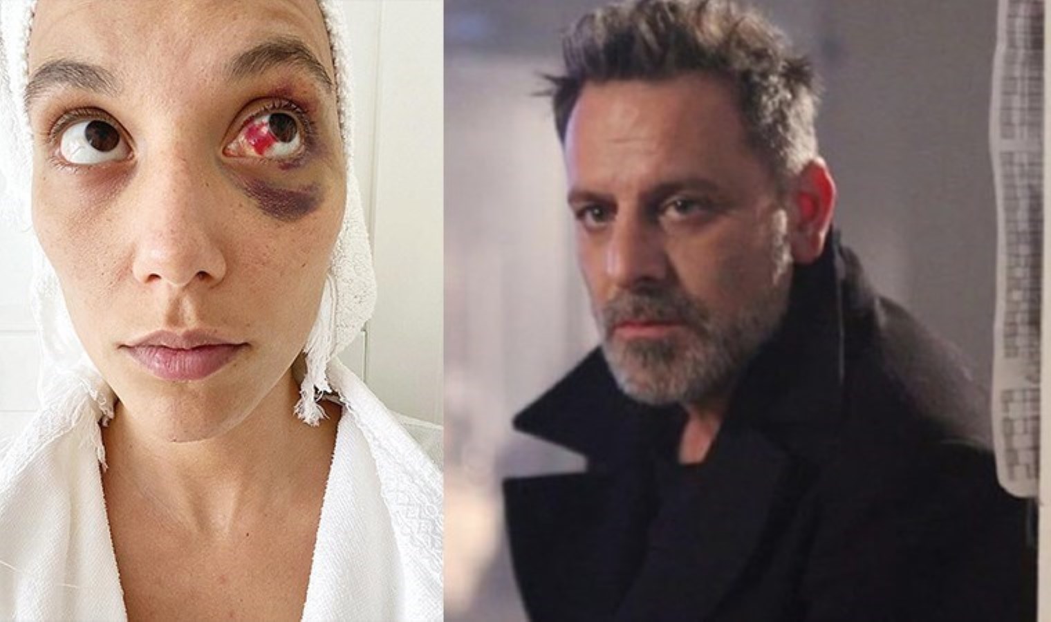 11 yıl 6 aya kadar hapsi istenmişti: Ozan Güven ‘kadına şiddet’ davası hakkında konuştu!