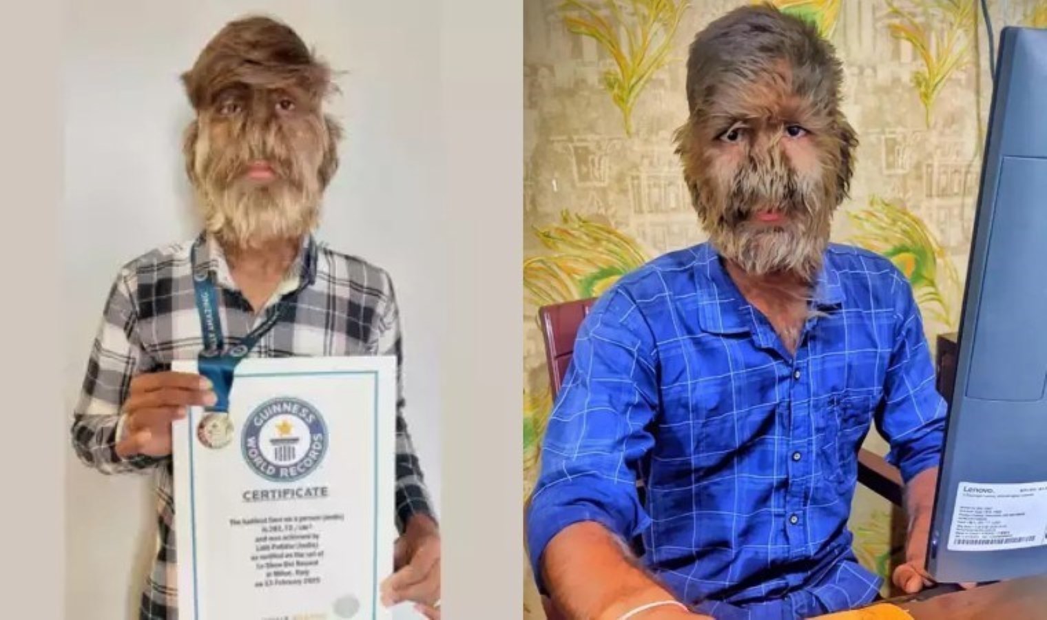 18 yaşında Guinness rekoru kırdı: ‘Dünyanın en kıllı yüzü’