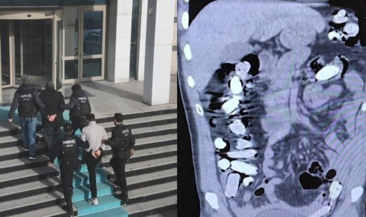 Bitlis’te iki kişinin mide ve bağırsaklarından 1 kilo 340 gram uyuşturucu çıktı!