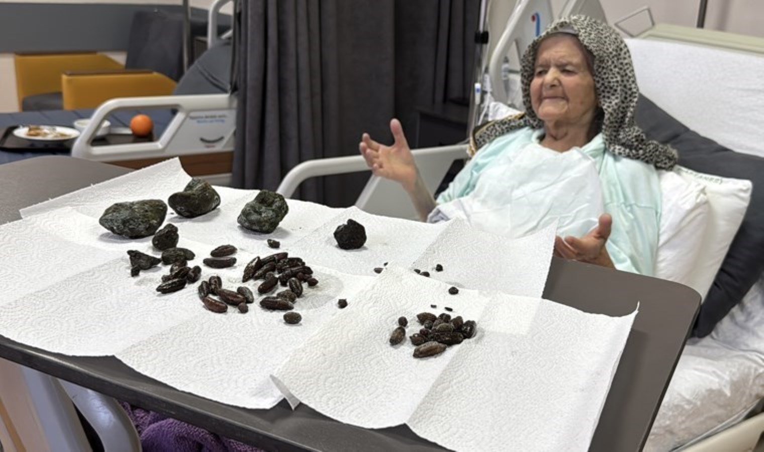 Doktorları bile şoke eden ameliyat: Zonguldak’ta 92 yaşındaki kadının midesinden 28 hurma, 35 zeytin çekirdeği ve 5 taş çıkarıldı