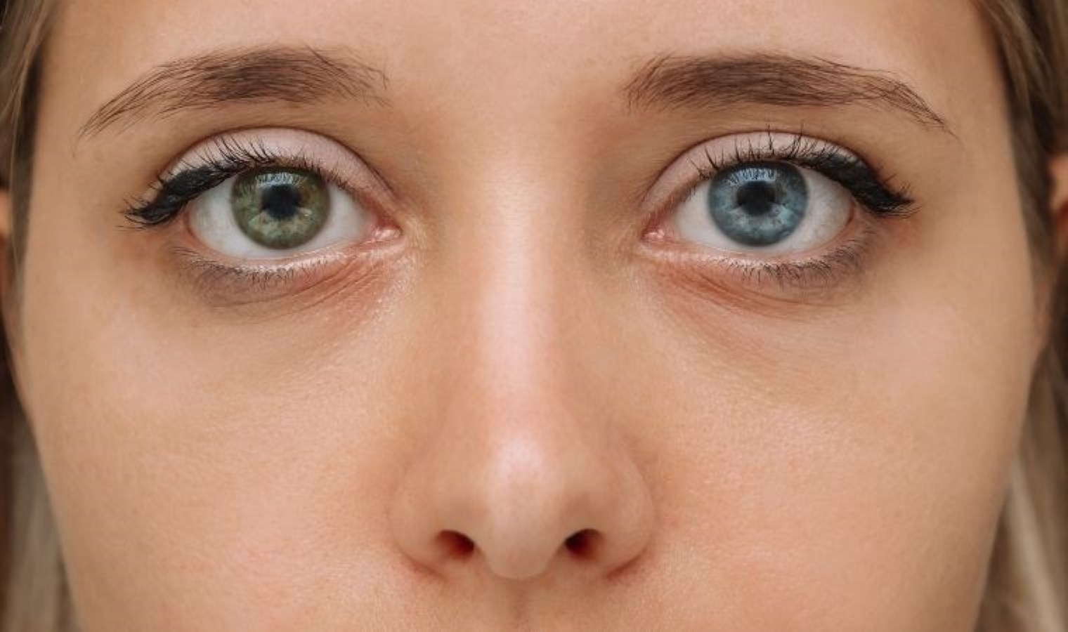 Farklı renklerdeki dikkat çeken gözler: Heterokromi nedir, neden olur? Heterokrominin çeşitleri nelerdir?