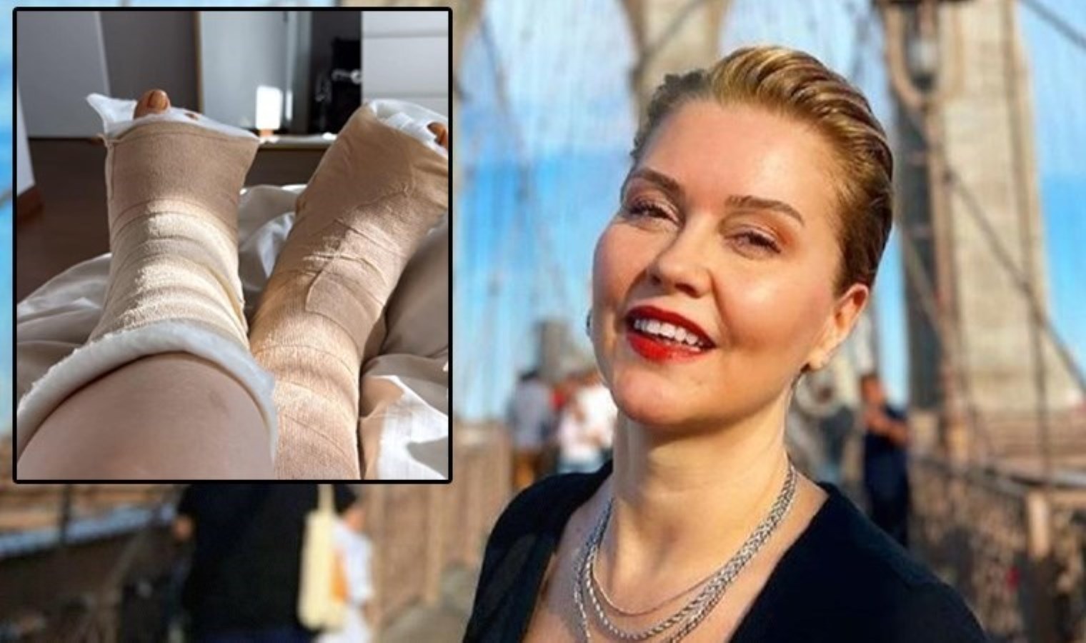 Haftalarca yürüyemeyecek… Didem Uzel’den ameliyat paylaşımı: ‘Çektiğim eziyeti anlatamam’