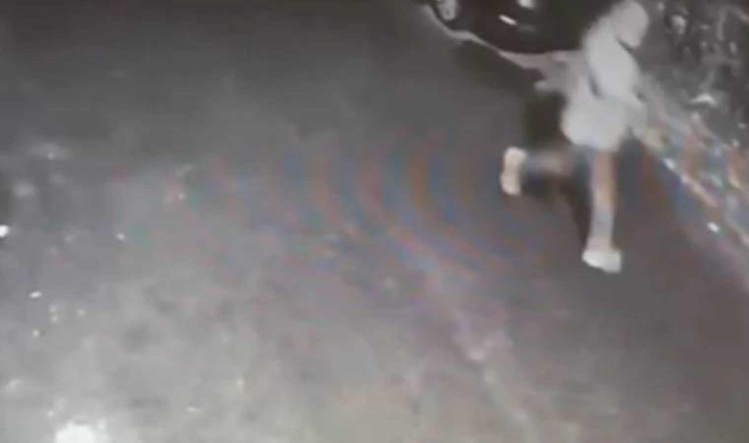 İstanbul’da erkek vahşeti! Görüşme talebini reddeden kadının yüzüne kezzap attı