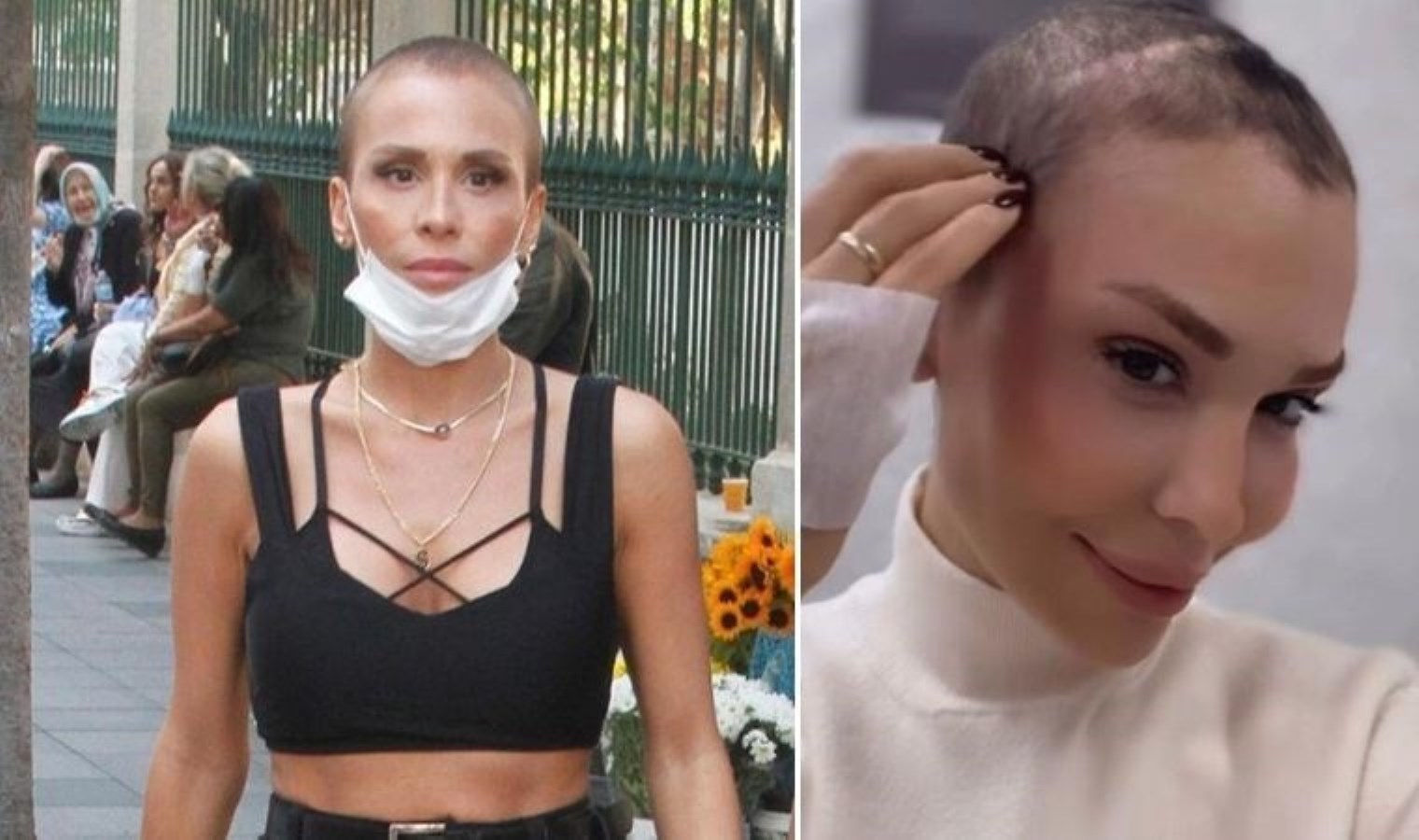 Kanseri yenen Şimal’den yeni paylaşım: ‘Saçlarım yerine gelmeye başladı’