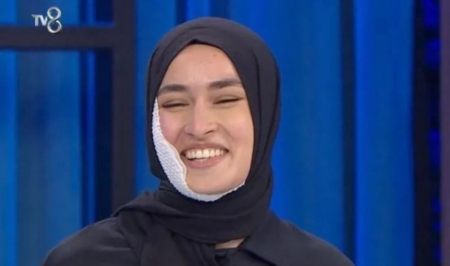 Masterchef yarışmacısı Beyza’nın yüzü yanmıştı: Aylar sonra ilk kez paylaştı!