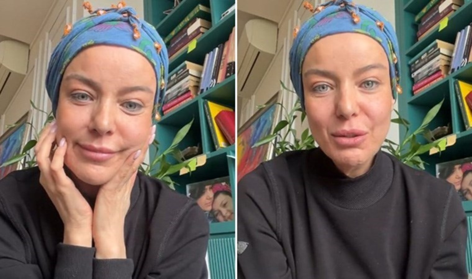 Nursel Ergin kanserle mücadelesini anlattı: ‘Saçlarım gitti, güzelliğim gitti, ama umudum gitmedi’