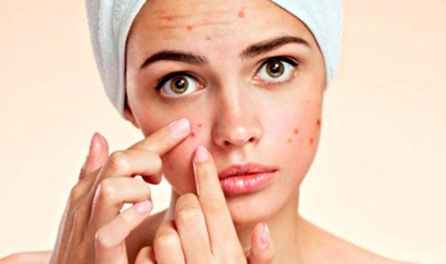 Sivilce sorununuzun arkasında bu davranışlar olabilir: Sivilce oluşumuna sebep olan 7 cilt bakım hatası