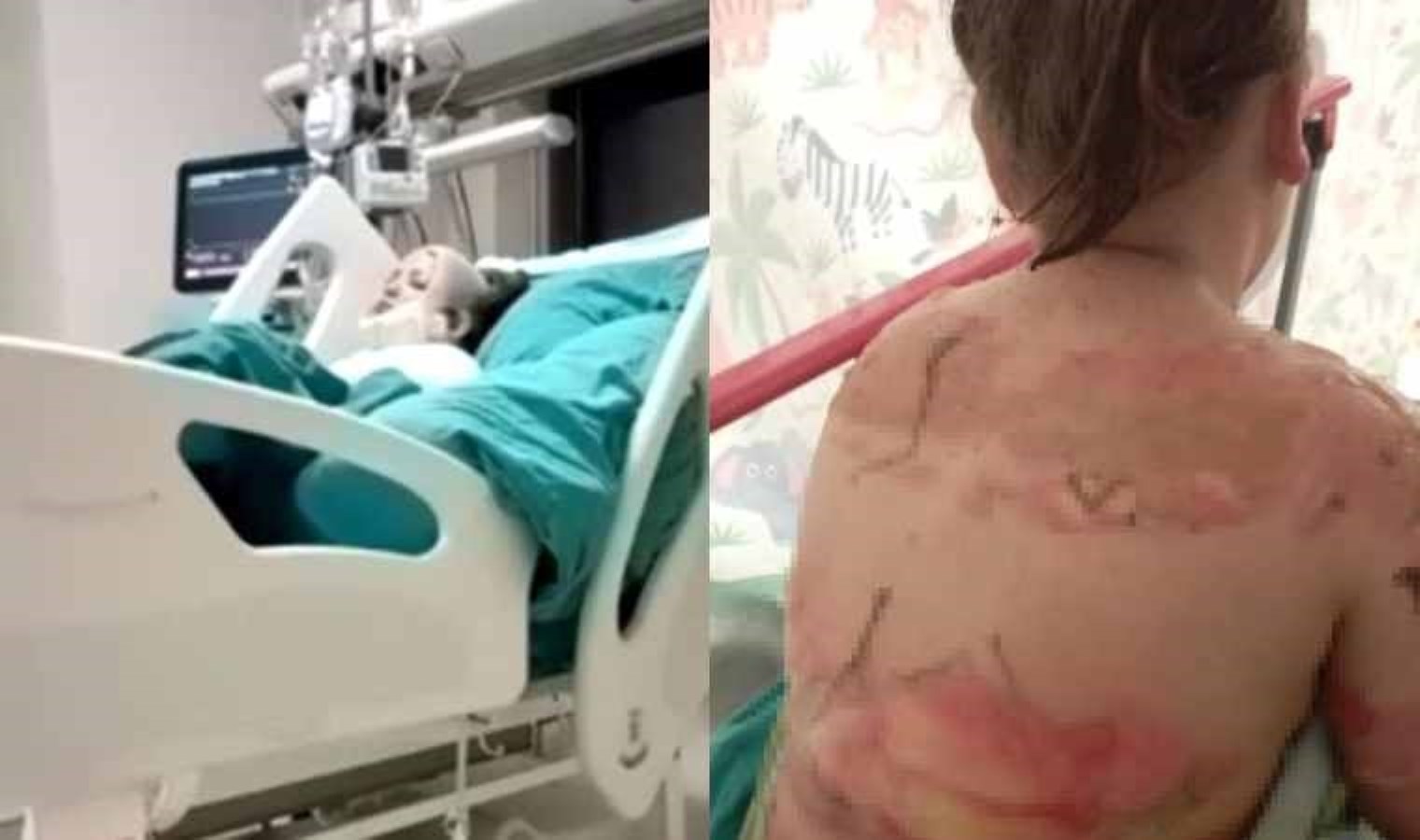 Sobada ısınmak isterken alev aldı! 10 yaşındaki çocuk okulda dehşeti yaşadı