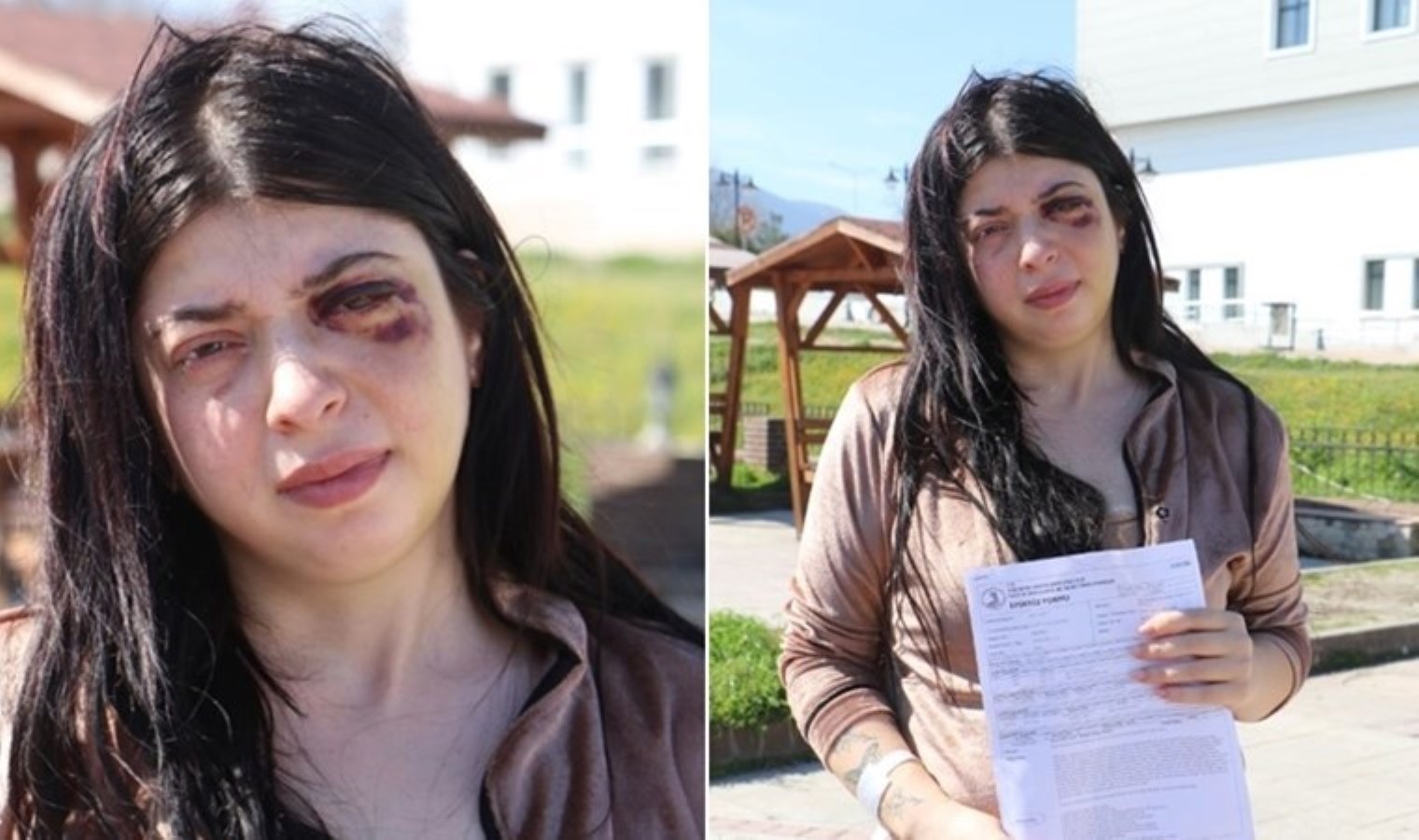 Sokak ortasında tacize uğrayıp darbedildi: ‘3 ay sıvı ile besleneceğim’