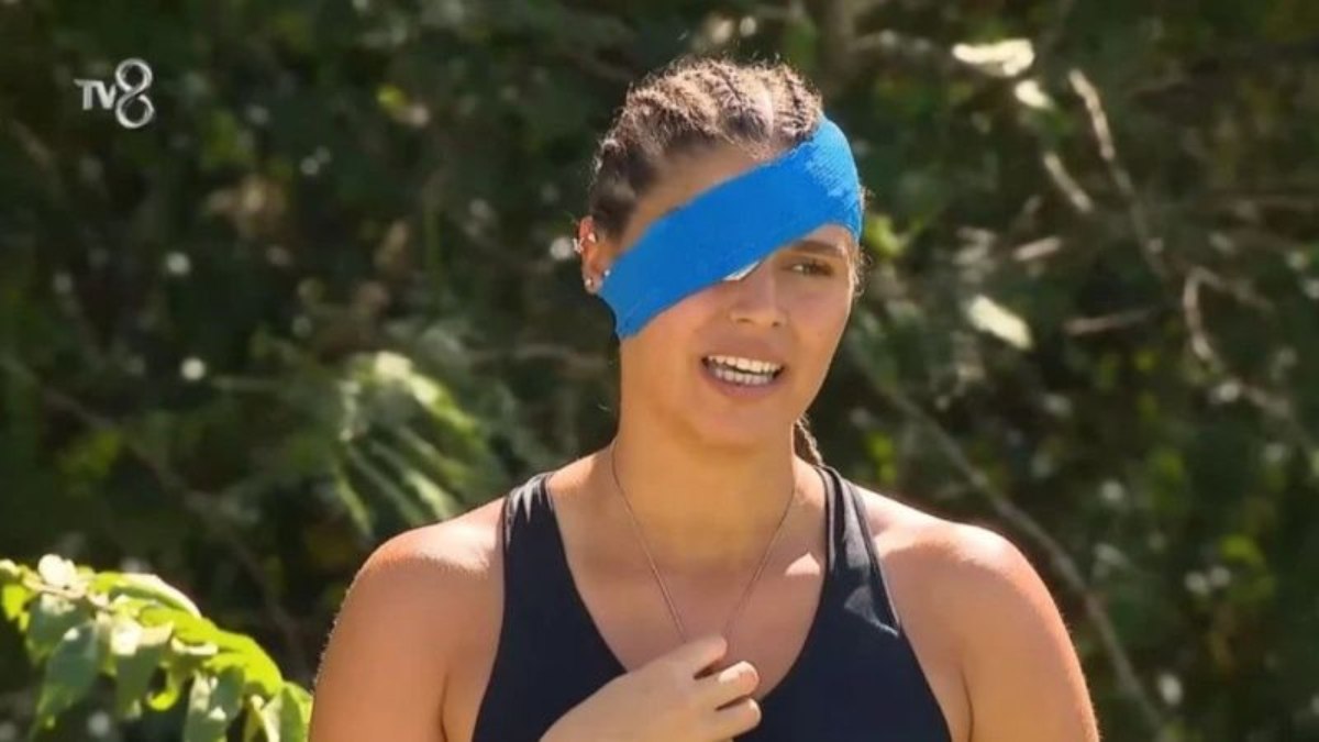 Yüzü gözü yanmıştı; Survivor Ayşe’ye ikinci darbe! Yarışmadan ayrılabilir…