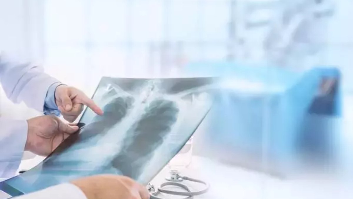 Zatürrenin belirtileri, bulaşma yolları, korunma yöntemleri