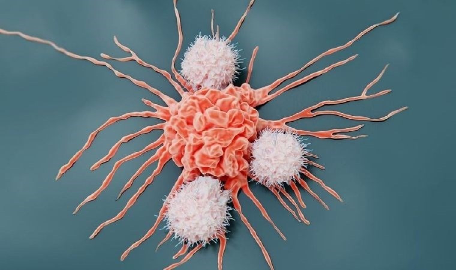 Masum gibi görünen bu alışkanlıklar tehlike saçıyor: Kansere yol açan 10 beslenme hatası