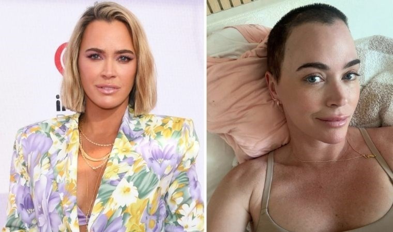 Realite şov yıldızı Teddi Mellencamp’tan kötü haber