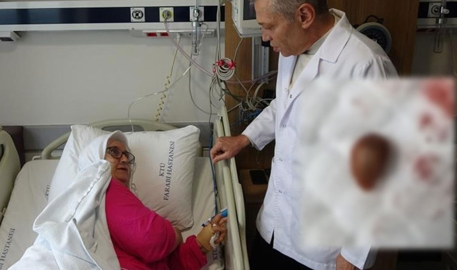 Soluk borusundan, akciğerine gitti: Yuttuğu ‘karayemiş çekirdeği’ az kalsın öldürüyordu!