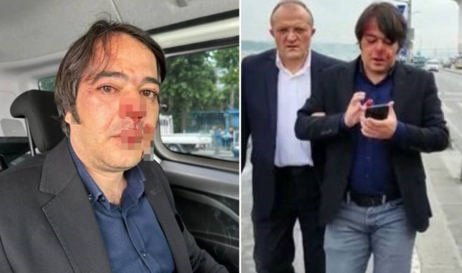 Üsküdar’daki kaçak kafeleri yıkarken saldırıya uğramıştı: İBB İmar Müdürü Ramazan Gülten de gözaltında