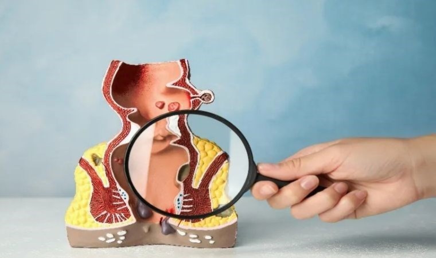 Anal kanserde endişe verici artış: Uzmanlar semptomlara dikkat çağrısı yapıyor