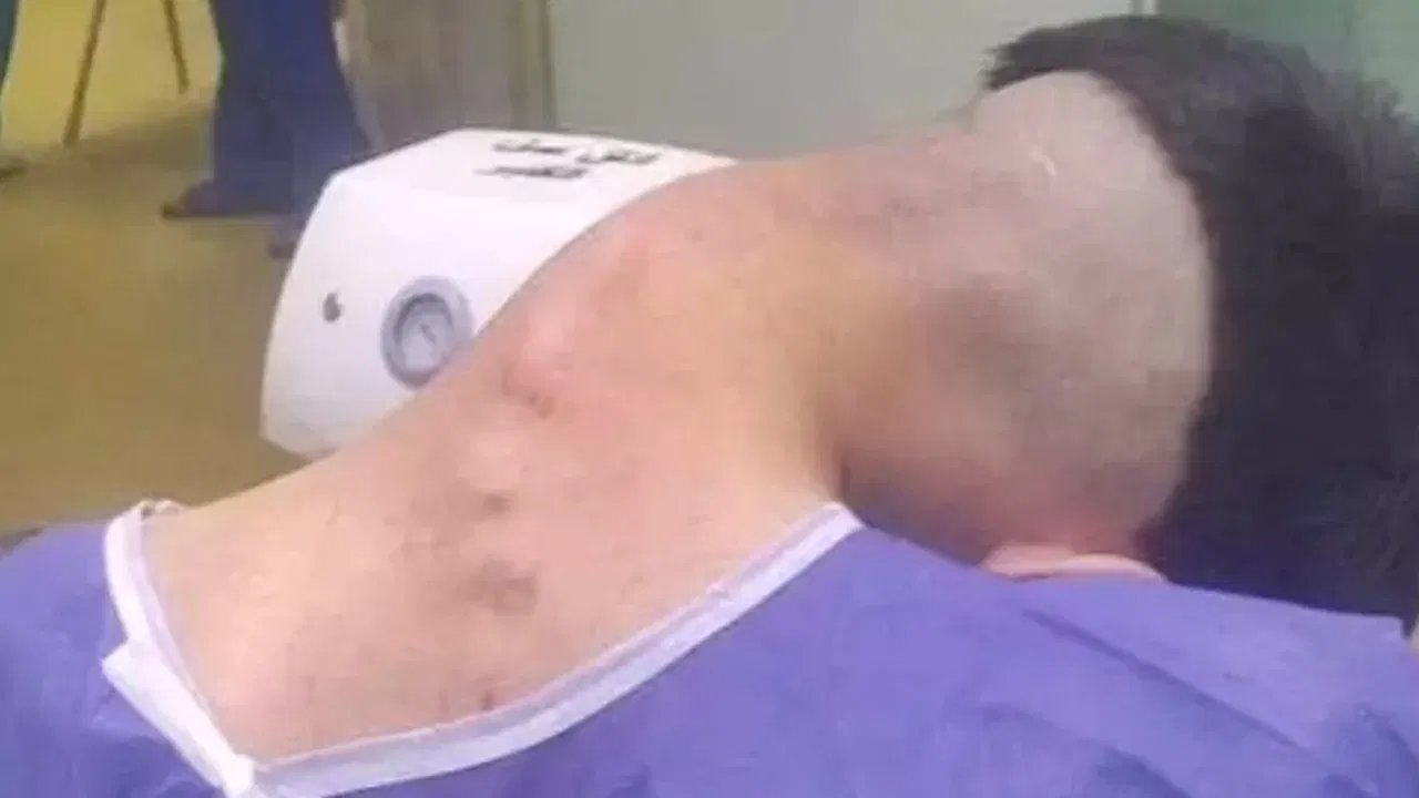 Bağımlılığın sonu ‘baş düşmesi’ sendromu oldu