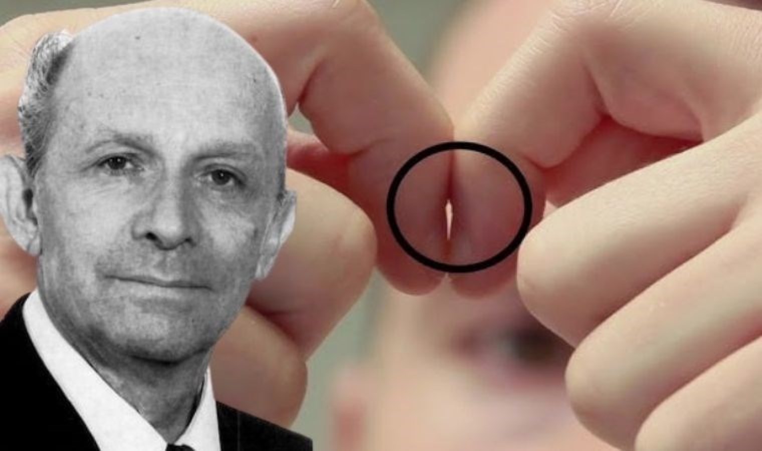 Bu basit parmak testi hastalıkları ortaya çıkarıyor