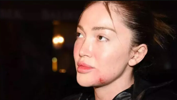 Danla Bilic’e saldırıdan tutuklanmıştı! Eski sevgili Berk Çetin’in annesi oğlunu ihbar etti