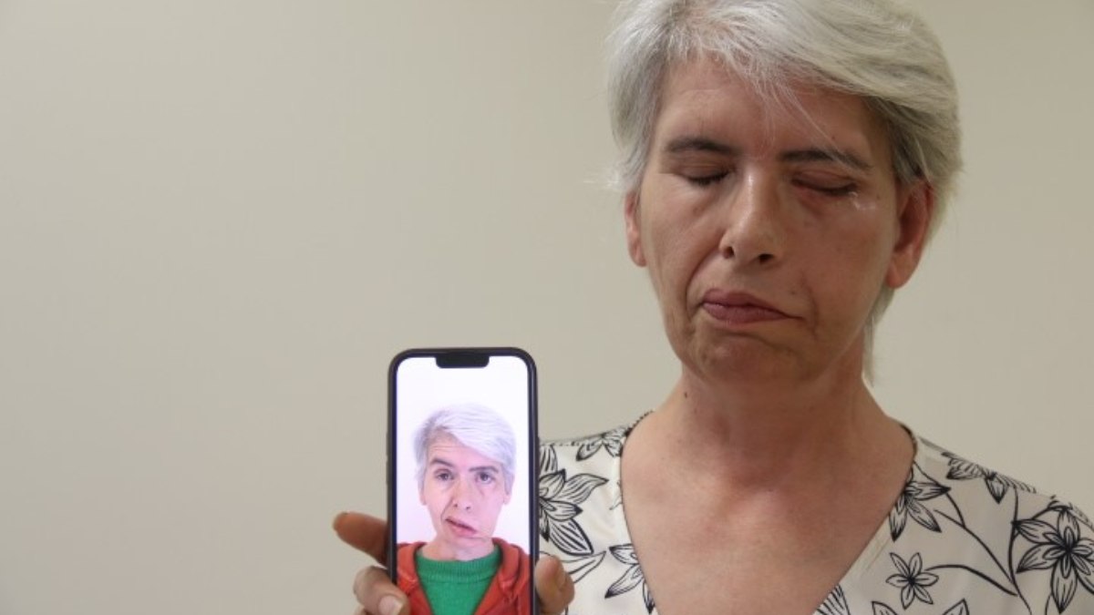 Eskişehir’de sol gözüne altınla tedavi yaptırdı