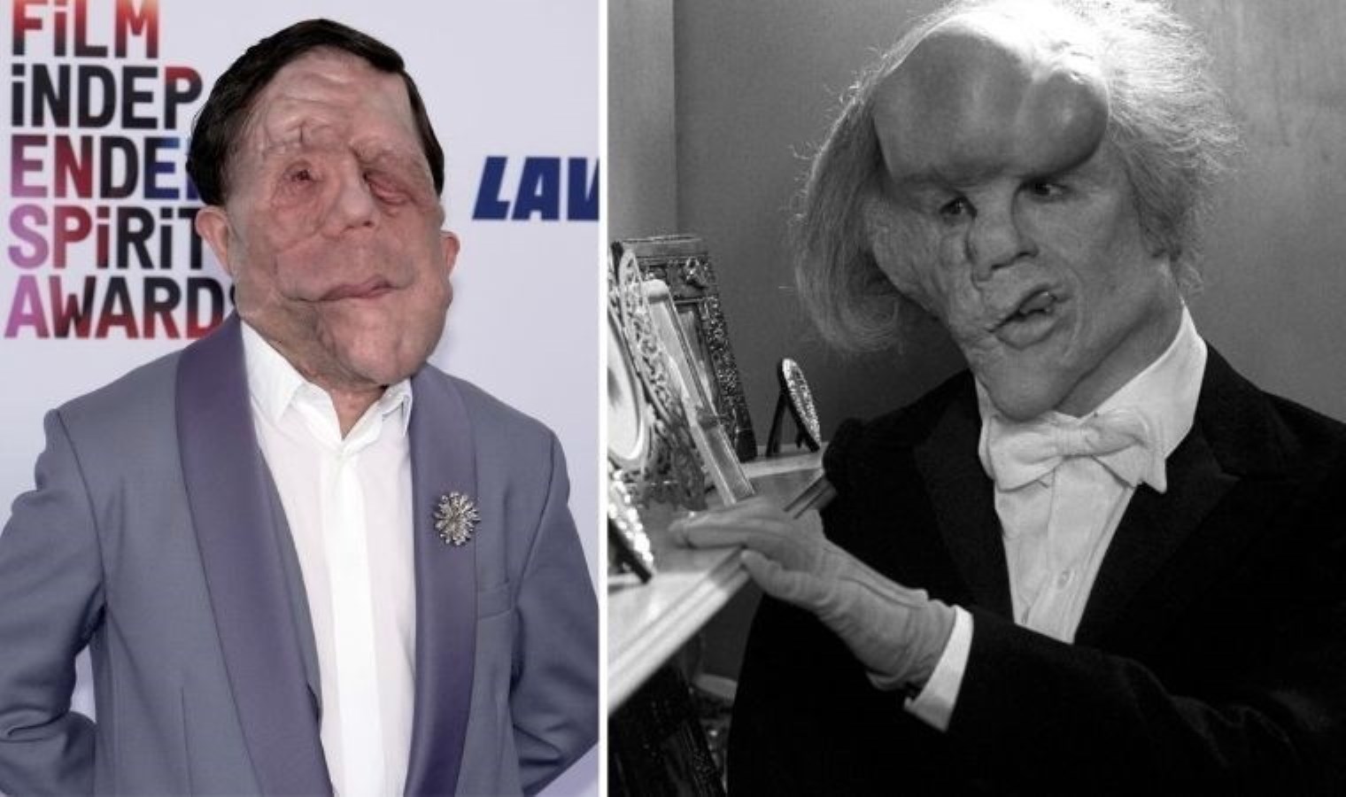 ‘Fil Adam’ yeniden beyazperdede: Başrol belli oldu!