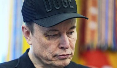 Gözündeki morluk dikkat çekmişti: Elon Musk nedenini açıkladı