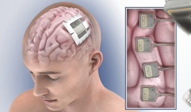 Neuralink rakibi şirket, bu yıl ilk beyin implantını üretecek
