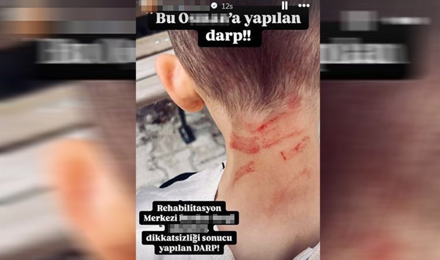 Rehabilitasyon merkezinde 5 yaşında çocuğa darp iddiası: Soruşturma başlatıldı!