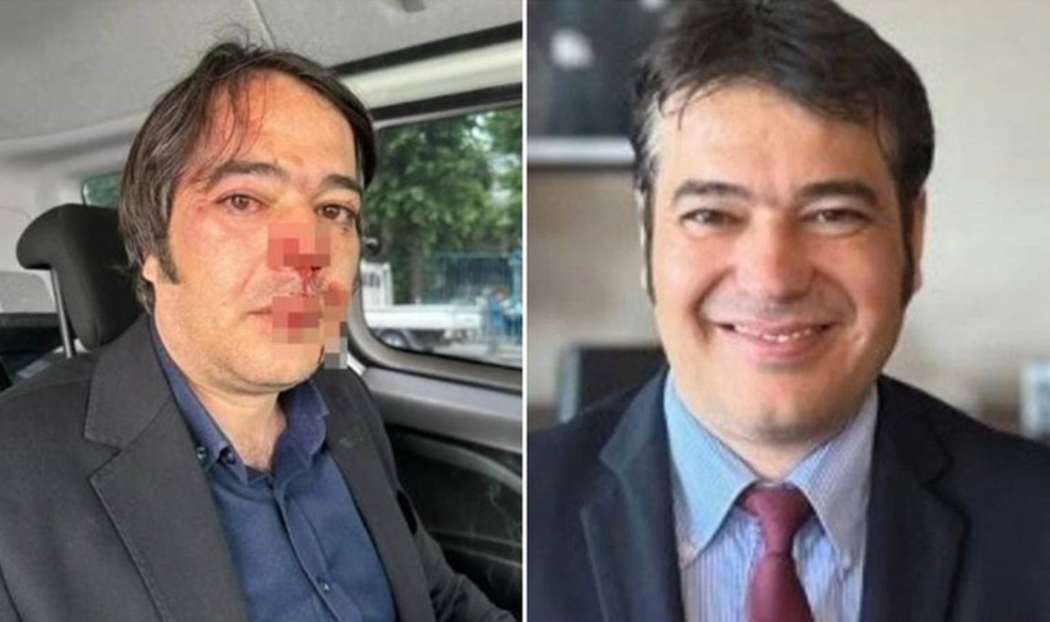 Üsküdar’daki kaçak kafeleri yıkarken saldırıya uğramıştı: İBB İmar Müdürü Ramazan Gülten’in ifadesi ortaya çıktı!