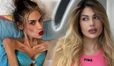 23 kiloya düşen Nihal Candan hayatını kaybetti… Son sözleri yürek yaktı: ‘Yaşayamıyorum’ demiş!