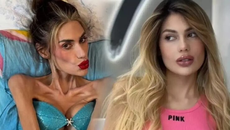 23 kiloya düşen Nihal Candan hayatını kaybetti… Son sözleri yürek yaktı: ‘Yaşayamıyorum’ demiş!