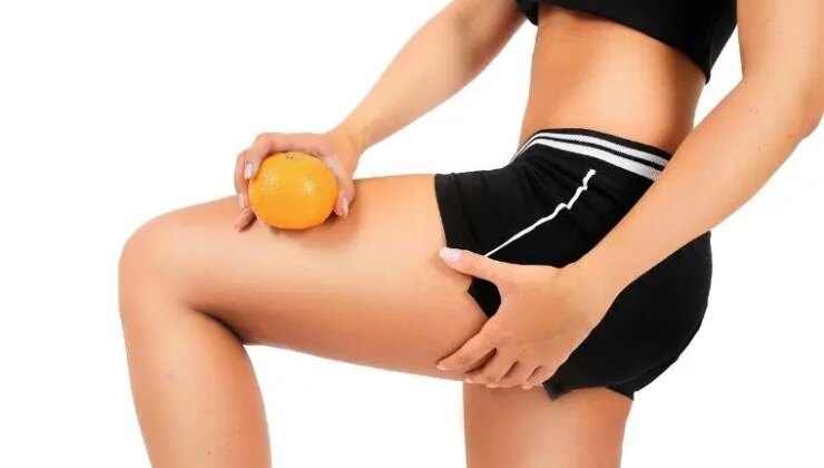 Doğadan gelen mucizelerle portakal görünümüne veda edin: Selülitlerden kurtulmayı sağlayan etkili 7 doğal yöntem