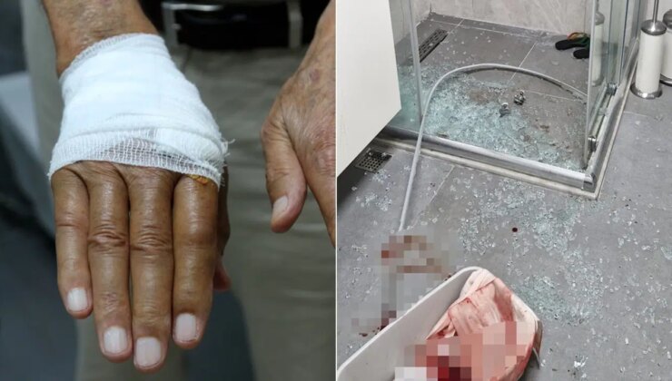Duşa kabin camı patladı… Emekli akademisyen yaralandı!