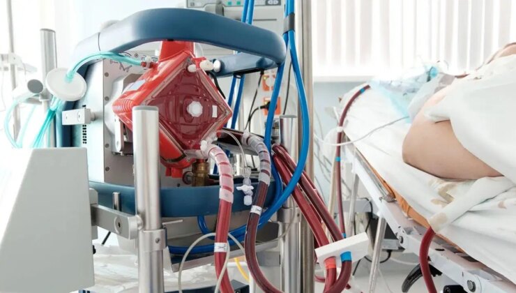 Ecmo nedir? Ecmo desteği ne demek?