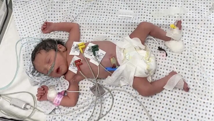 Gazze’deki iki hastaneden ‘mamalar tükendi, bebek ölümleri görülebilir’ açıklaması