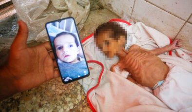İsrail ablukası altındaki Gazze’de 3 aylık Curi de açlıktan can verdi
