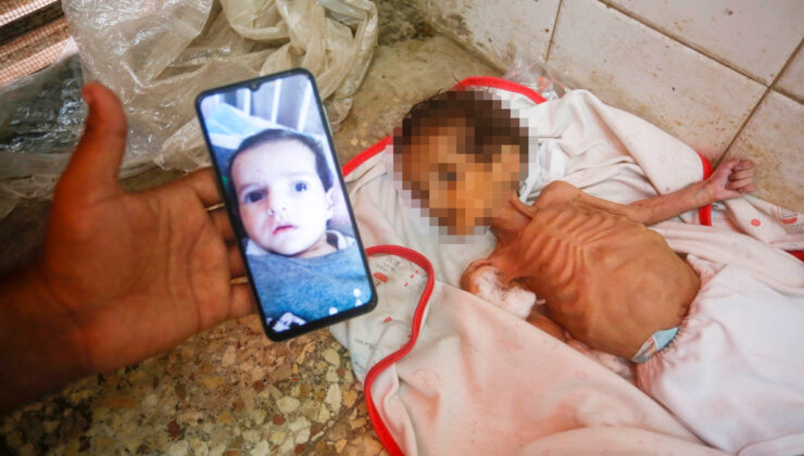 İsrail ablukası altındaki Gazze’de 3 aylık Curi de açlıktan can verdi