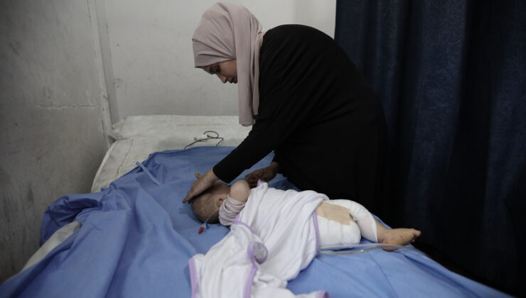 İsrail’in Gazze’ye yönelik bombardımanında 4 aylık bebek bir bacağını kaybetti