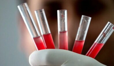 Kan biliminde tarihi keşif: Dünya üzerinde sadece bir kişide bulunan yeni kan grubu bulundu