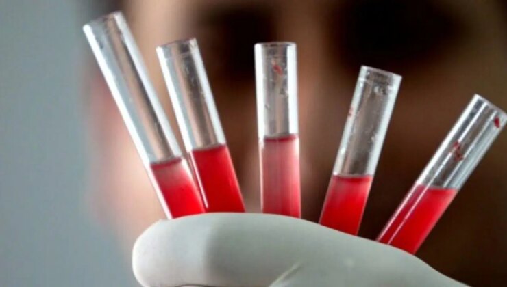 Kan biliminde tarihi keşif: Dünya üzerinde sadece bir kişide bulunan yeni kan grubu bulundu