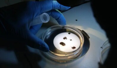 Sağlık Bakanlığı’ndan dikkat çeken açıklama: Kene yoğunluğunda artış mı var?