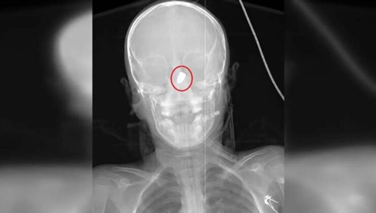 ‘Silah sesi duyduğunuzda balkona pencereye koşmayın, gizlenin’