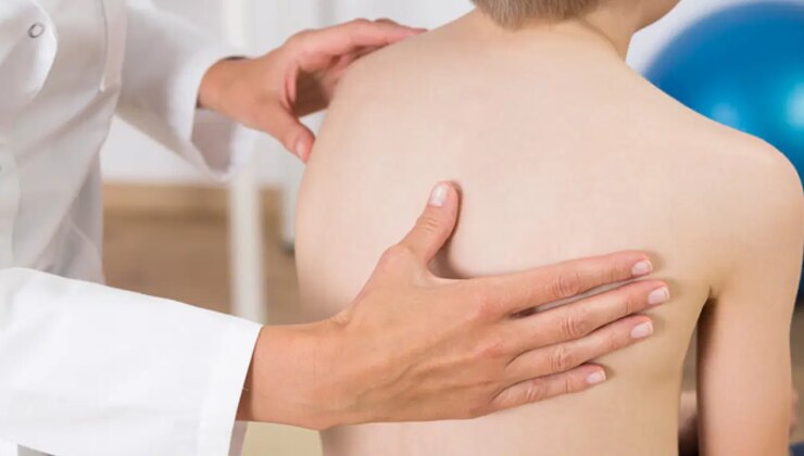 Uzmandan ‘skolyoz’ uyarısı: ‘Çocuklukta fark edilmesi tedavide kritik önem taşıyor’