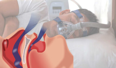 Uzmanlardan bayram dönüş yolunda ‘uyku apnesi’ uyarısı