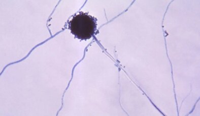 Uzmanlardan ölümcül mantar uyarısı: Soluduğunuz hava bile tehlikeli olabilir