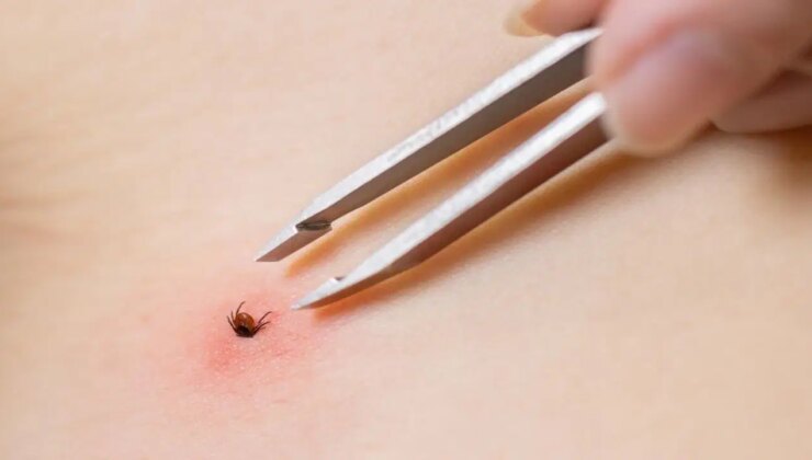 Yaz aylarının kabusu geri döndü:  Keneden korunmanın basit ama etkili yolları neler?