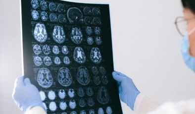 Alzheimer’a virüsler mi yol açıyor?